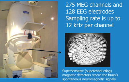 275 MEG channels and 128 EEG electrodes. Sampling rate is up to 12 kHz per channel. Supersensitive (superconducting) magnetic detectors record the brain's spontaneous neuromagnetic signals.